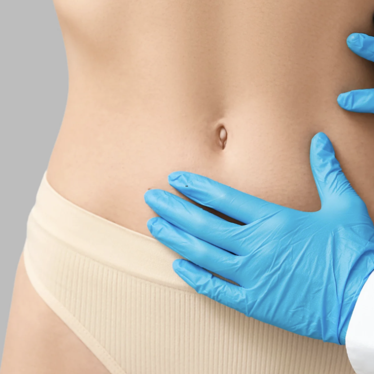 Liposuction Costs in Fairfax VA